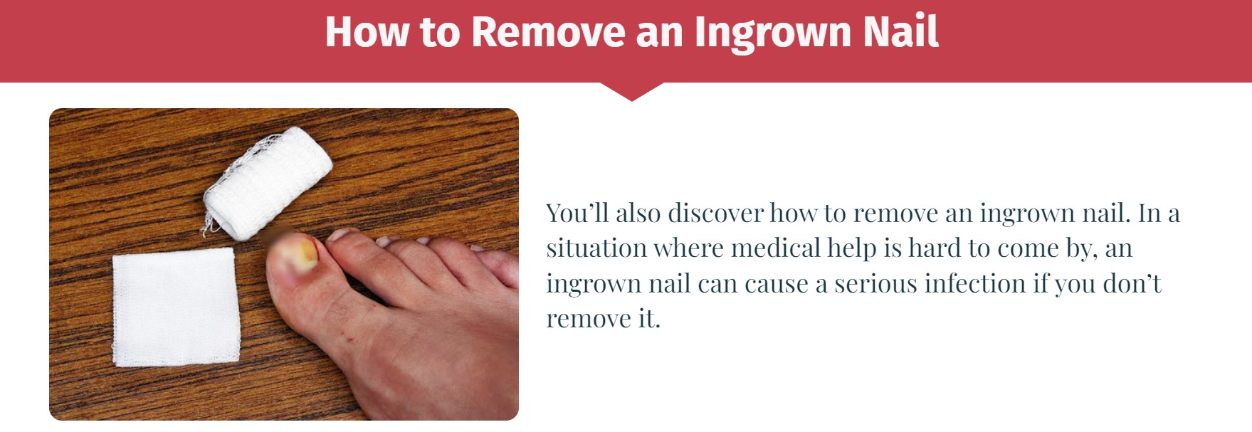 Home Doctor Book - Ingrown Nail Treatment